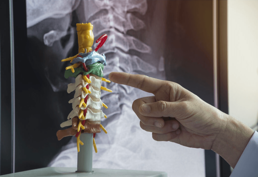 An xray with a doctor showing a spine